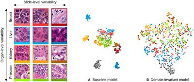 Learning Domain-Invariant Representations of Histological Images